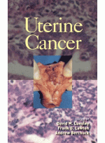 Uterine Cancer