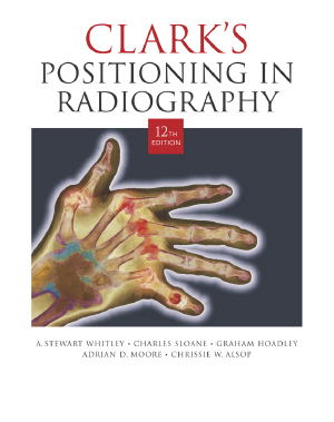Clark's Positioning In Radiography, 12e