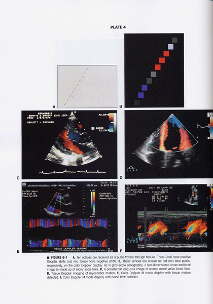 Diagnostic Ultrasound: Principles And Instruments