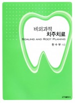 비외과적 치주치료(Scaling and Root Planing)