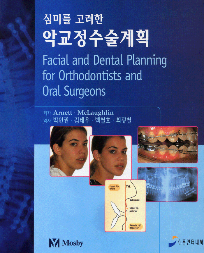심미를 고려한 악교정수술계획