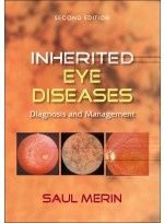 Inherited Eye Diseases