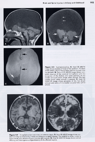 Pediatric Neuroimaging 4/e