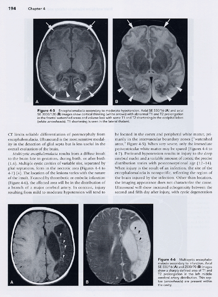 Pediatric Neuroimaging 4/e