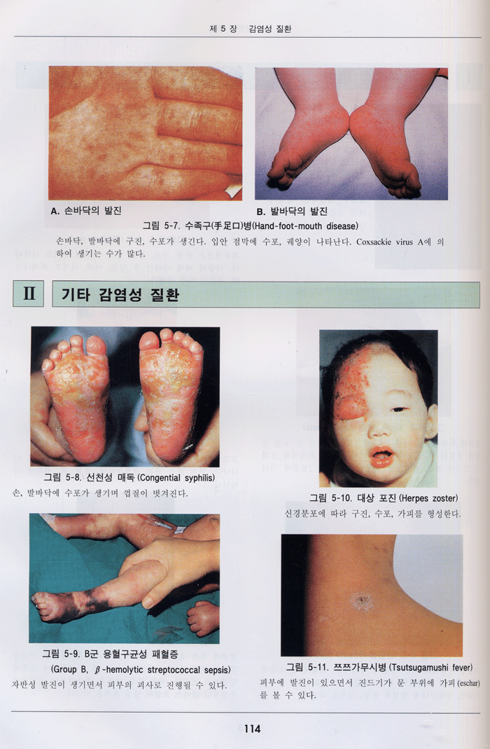 소아과 아틀라스 2판