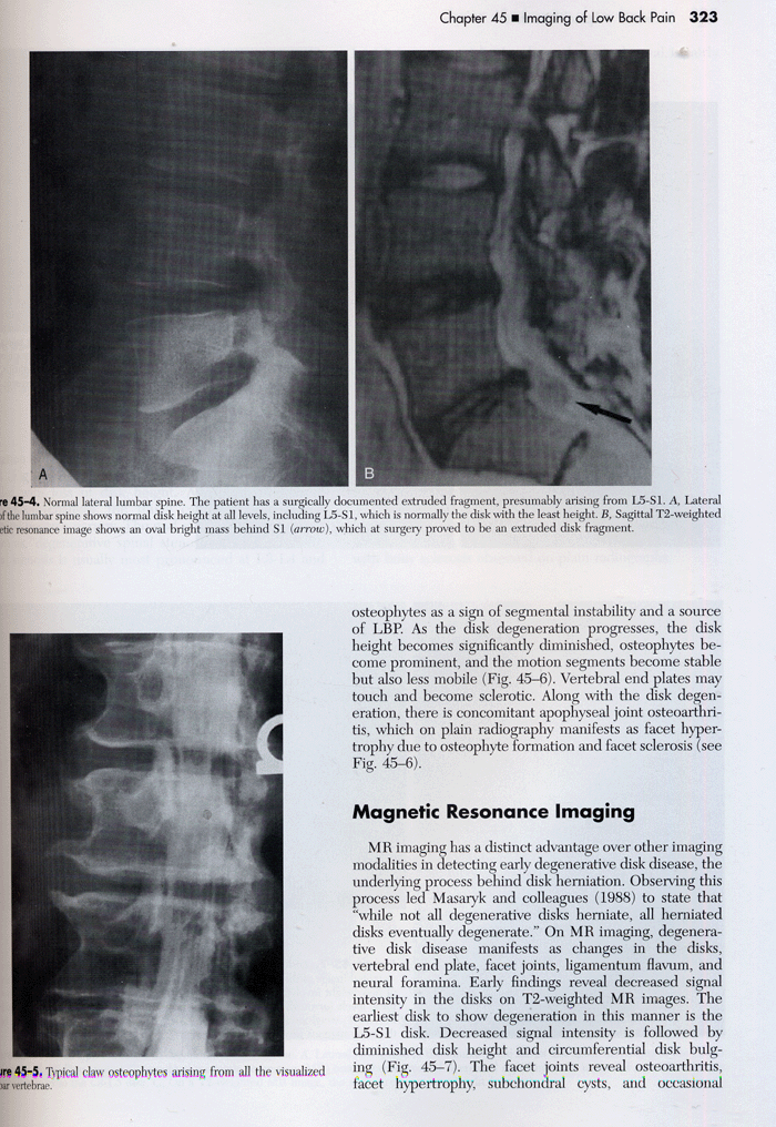 Essentials of Musculoskeletal Imaging