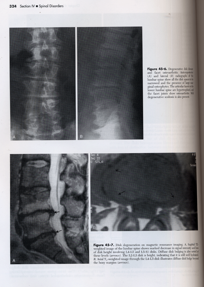 Essentials of Musculoskeletal Imaging