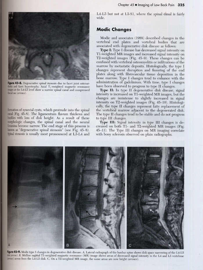 Essentials of Musculoskeletal Imaging