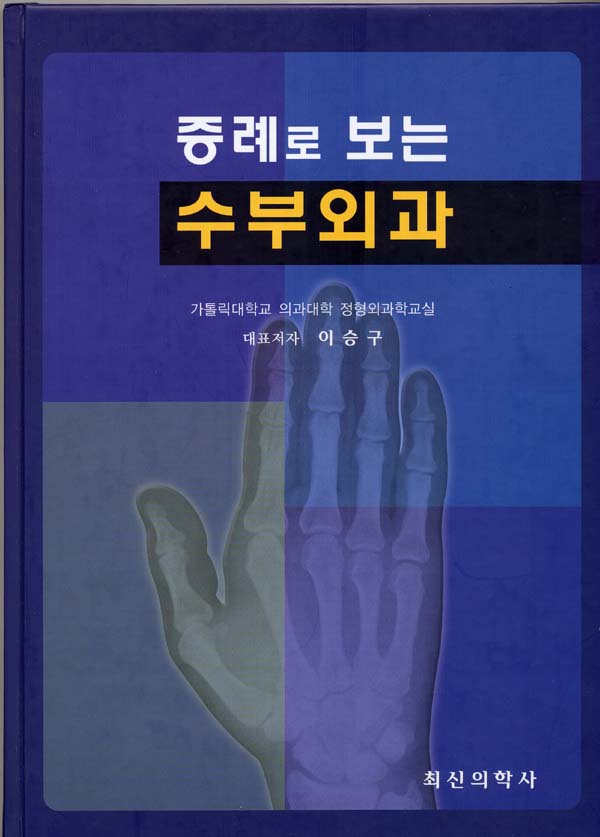 증례로 보는 수부외과