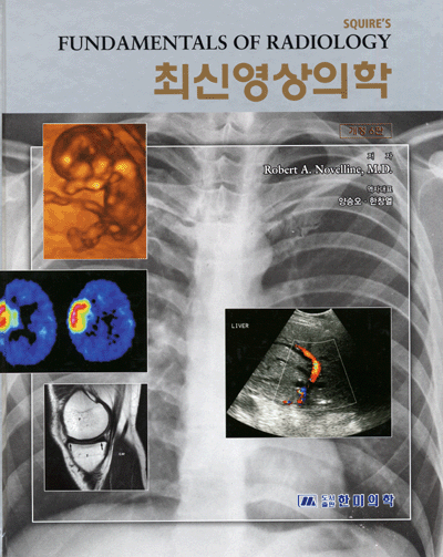 최신영상의학 (개정6판) Squire's Fundamentals of Radiology 6/E