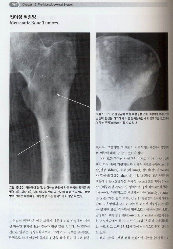 최신영상의학 (개정6판) Squire's Fundamentals of Radiology 6/E