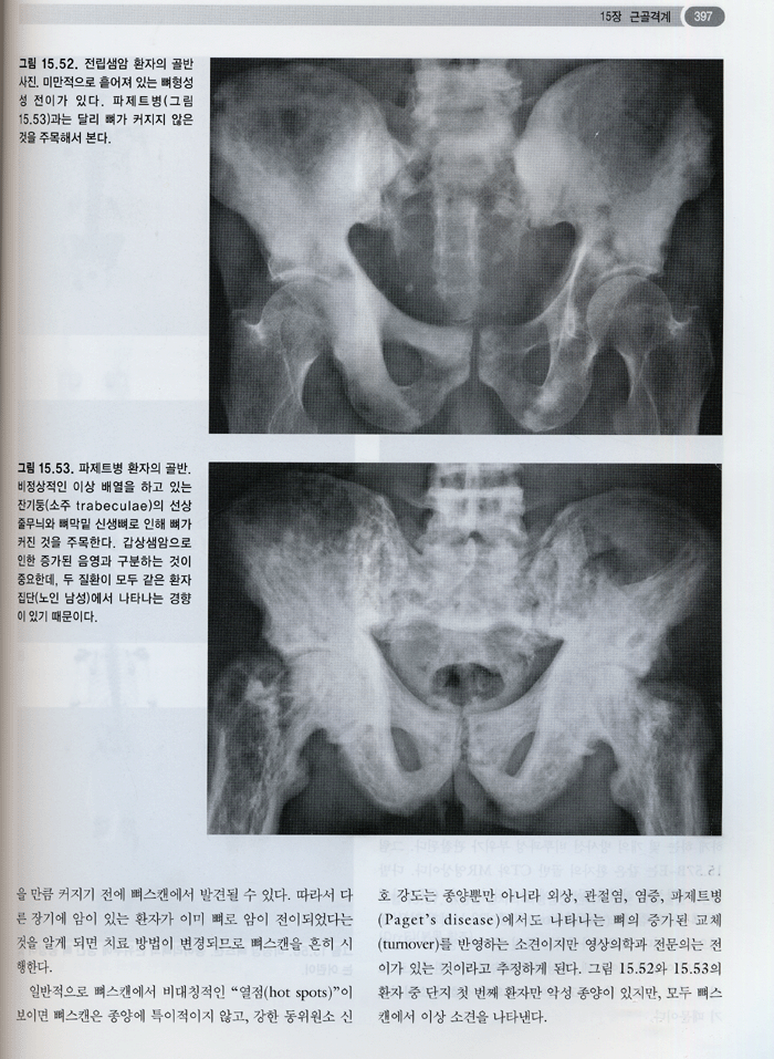 최신영상의학 (개정6판) Squire's Fundamentals of Radiology 6/E