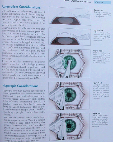 Custom Lasik: Surgical Techniques and Complications , 3rd edition