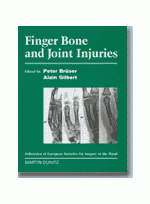 Finger Bone and Joint Injuries