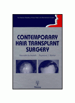 Contemporary Hair Transplant Surgery