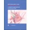 Dupuytren's Disease