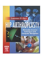 Hip Arthroplasty - Minimally Invasive Techniques and Computer Navigation Textbook with DVD-ROMS