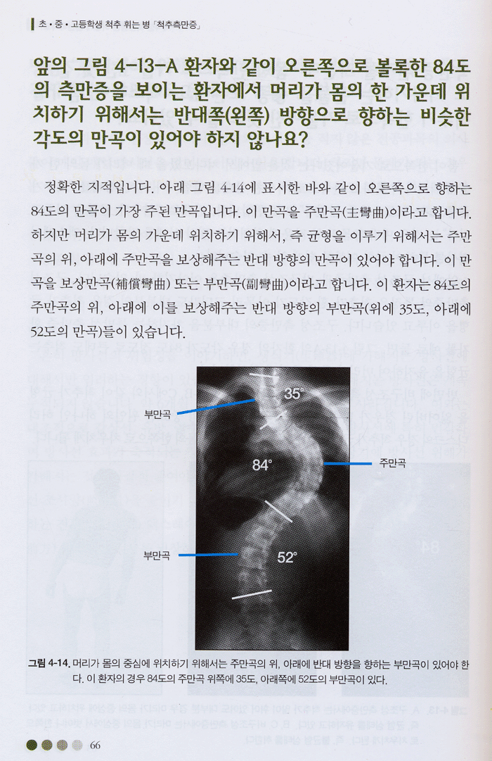 척추측만증 (추나학회)