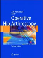 Operative Hip Arthroscopy, 2th edition