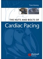 Nuts and Bolts of Cardiac Pacing
