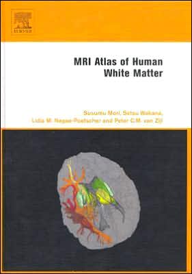 MRI Atlas of Human White Matter