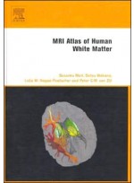 MRI Atlas of Human White Matter