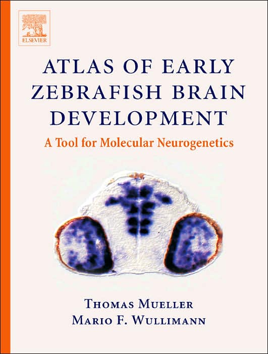 Atlas of Early Zebrafish Brain Development : A Tool for Molecular Neurogenetics