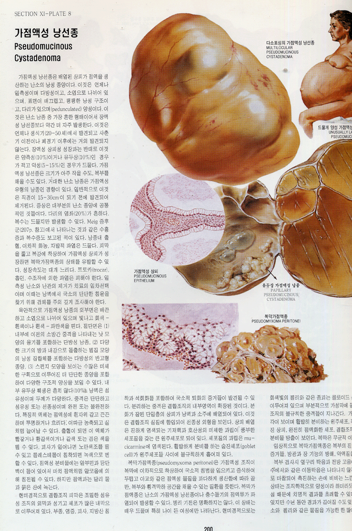 CIBA 원색도해의학총서 (전 13권, 색인1권)