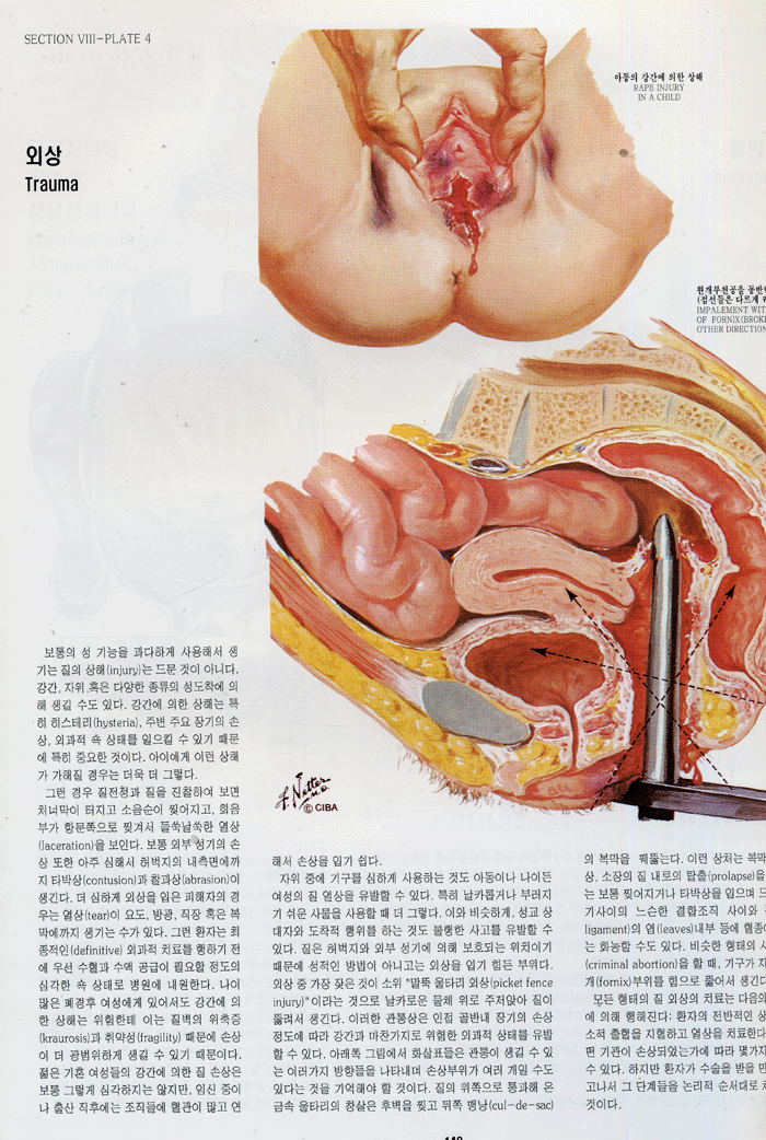 CIBA 원색도해의학총서 (전 13권, 색인1권)