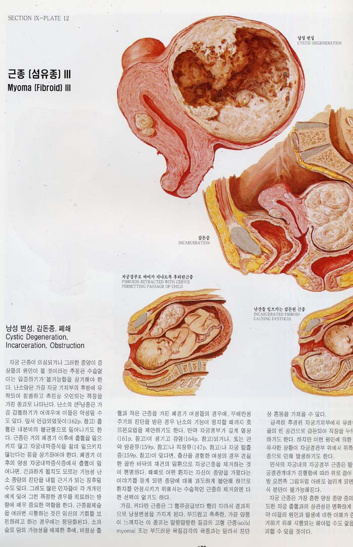 CIBA 원색도해의학총서 (전 13권, 색인1권)