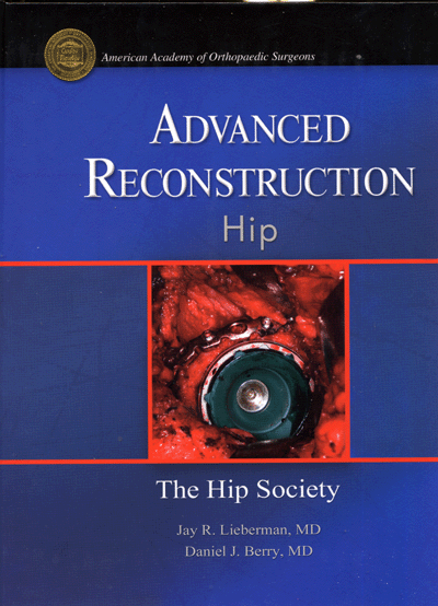 Advanced Reconstruction Hip