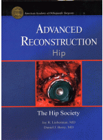 Advanced Reconstruction Hip