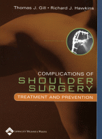 Complications of Shoulder Surgery Treatment and Prevention
