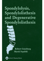 Spondylosis Spondylolisthesis & Degenerative Spondylolisthesis