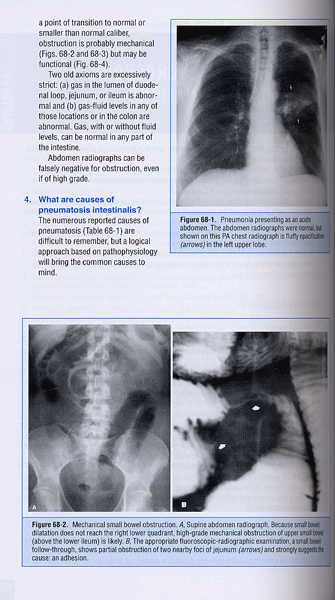 GI/LIVER Secrets (3e)