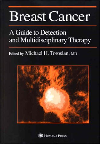 Breast Cancer: A Guide to Detection and Multidisciplinary Therapy