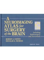 A Neuroimaging Atlas for Surgery of the Brain: Including Radiosurgery and Stereotaxis