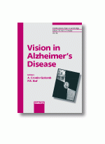 Vision in Alzheimer's Disease