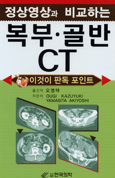 정상영상과 비교하는 복부 골반 CT