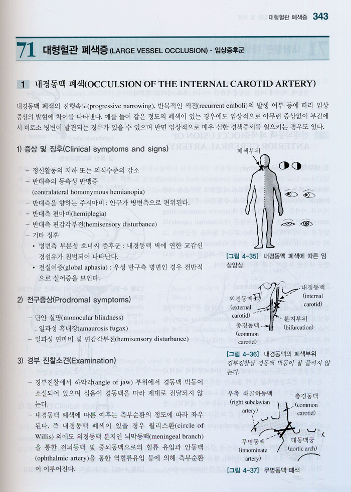 임상신경학, 4/e