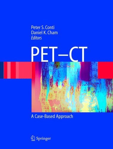 PET-CT : A Case Based Approach