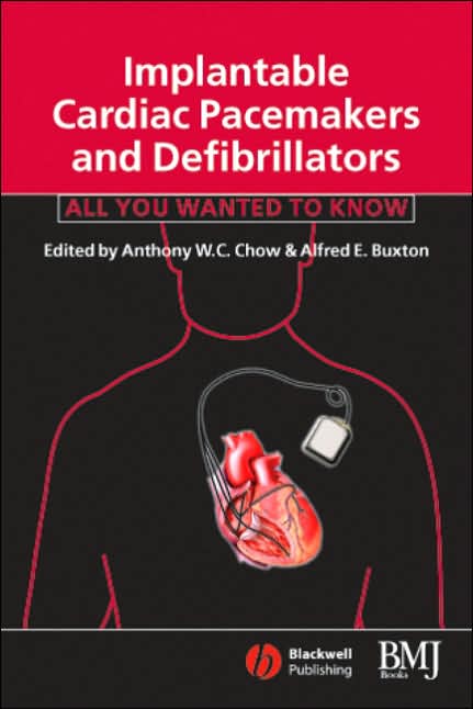 Implantable Cardiac Pacemakers and Defibrillators: All You Wanted to Know