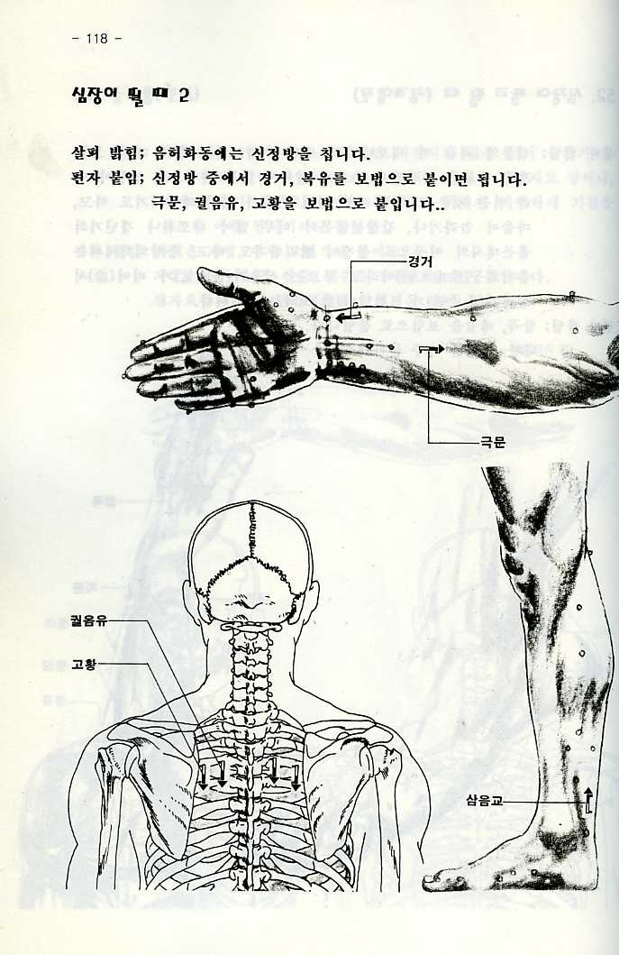 편자요법-누구나할수있는무통건강관리비법