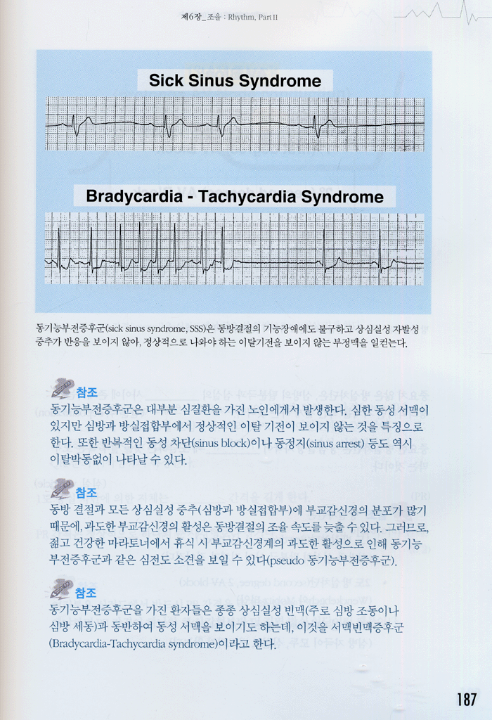 심전도 속성판독법 (군자)