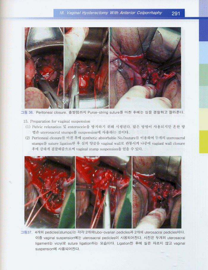 산부인과 수술술기 (2006년 개정판)