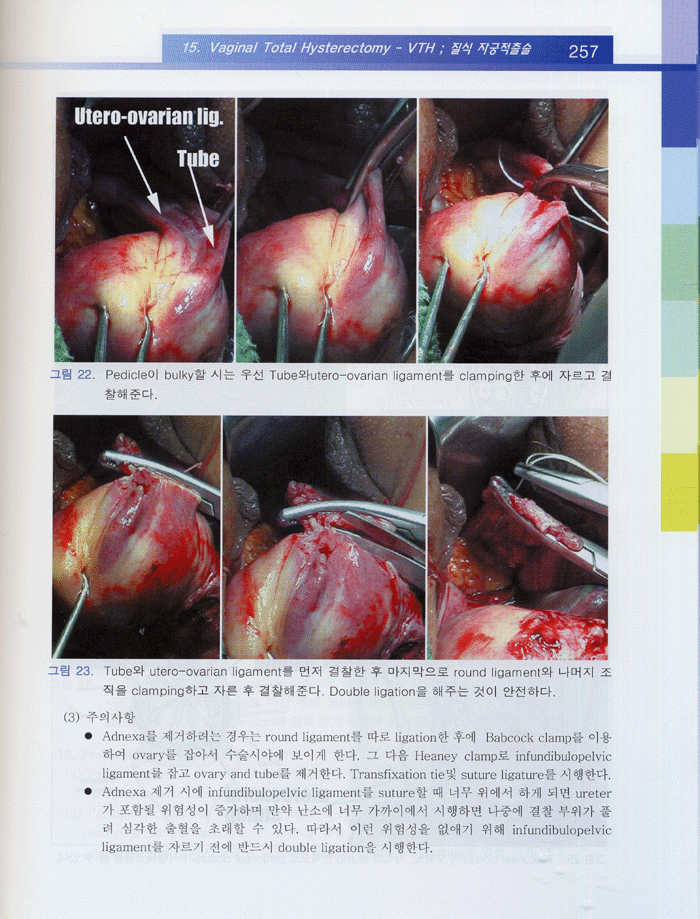 산부인과 수술술기 (2006년 개정판)