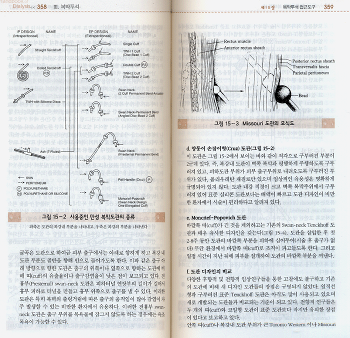 최신 투석 매뉴얼