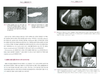 대한소화기학회총서11-췌장암