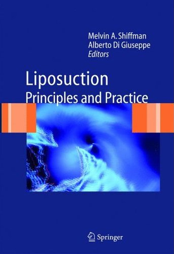 Liposuction : Principles and Practice