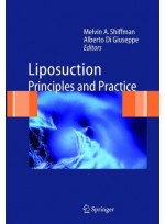 Liposuction : Principles and Practice